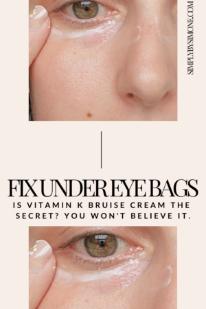 Will Vitamin K Get Rid Of Your Under Eye Bags? You Won't Believe This