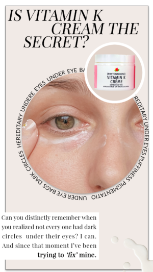 Will Vitamin K Get Rid Of Your Under Eye Bags? You Won't Believe This